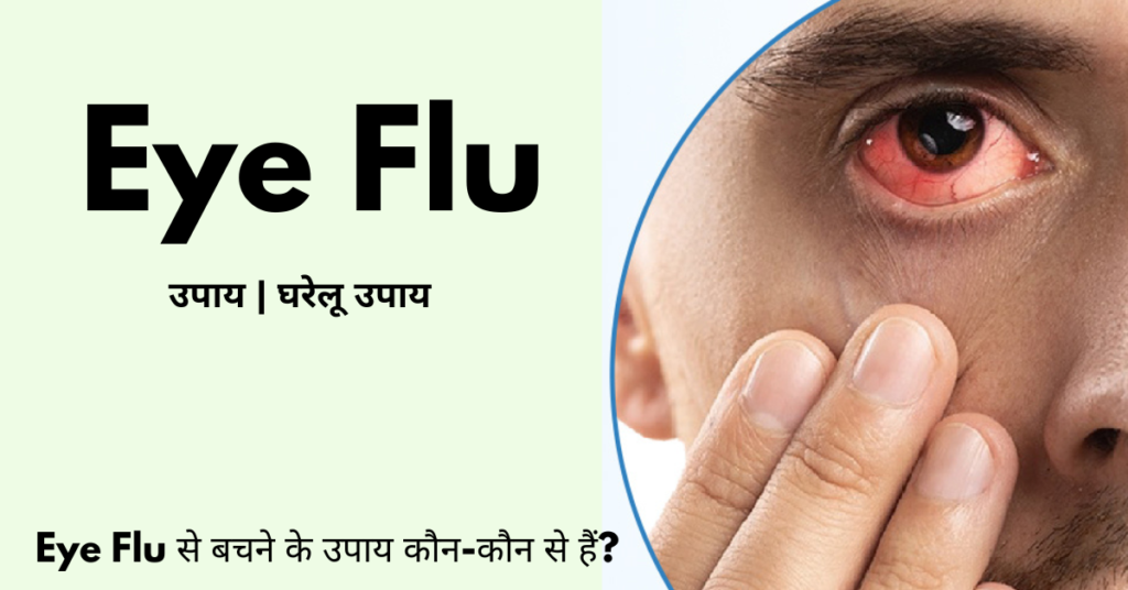 Eye Flu से बचने के उपाय कौन-कौन से हैं?